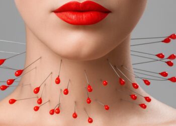 Симптоми на болна щитовидна жлеза – подуване на шията, умора, хормонален дисбаланс.