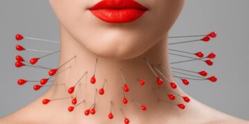 Симптоми на болна щитовидна жлеза – подуване на шията, умора, хормонален дисбаланс.