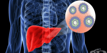 Хепатит Б – вирусна инфекция на черния дроб и основни симптоми